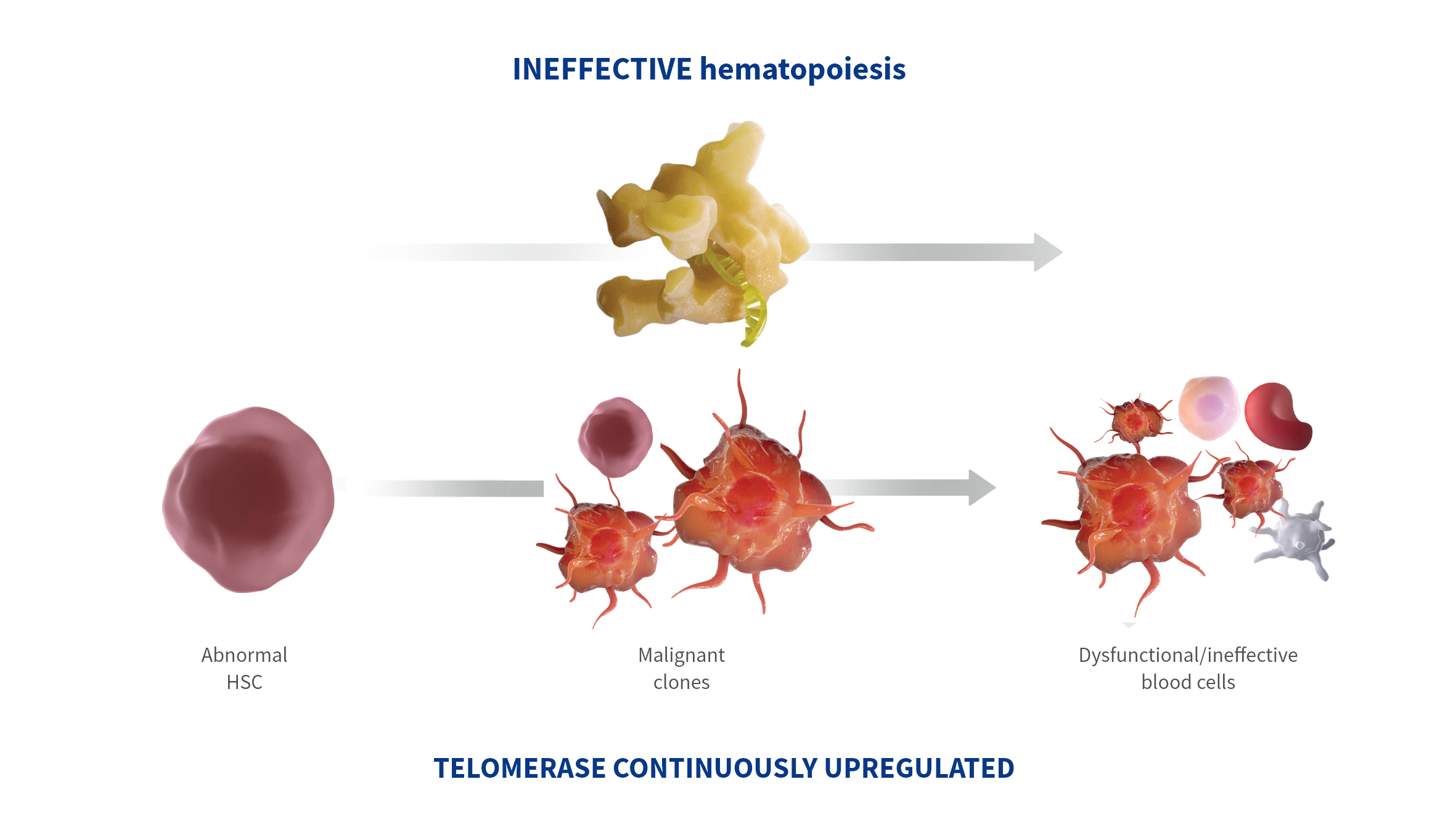 Graphic of a diagram showing maglinant stem cells developing into dysfunctional blood cells due to telomerase overexpression.