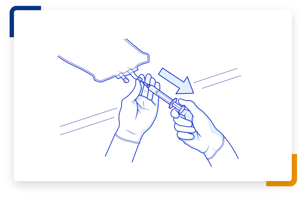 Step 2 illustration with a syringe going into an IV bag with an arrow facing away.